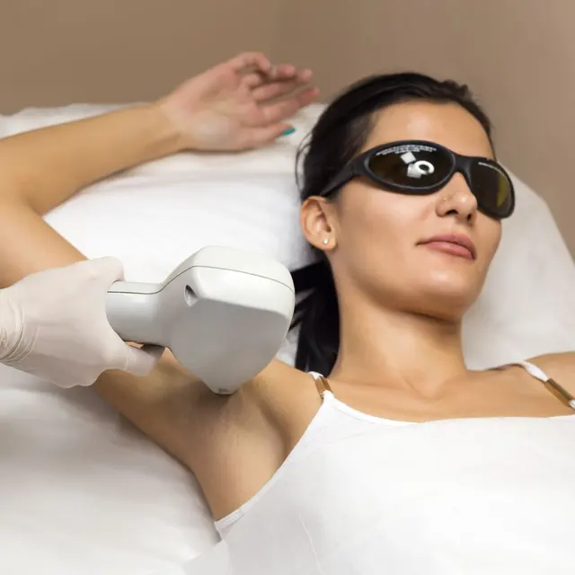 Patient wearing protective eyewear during an IPL laser treatment