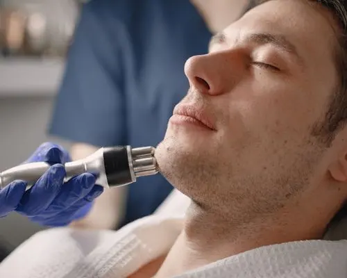 Laser handpiece treating the skin of a man’s cheek