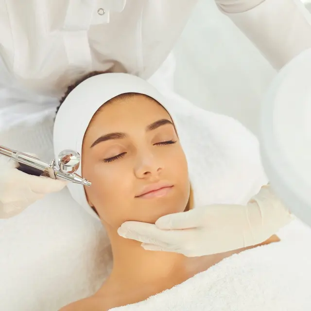 Microneedling device being used on a patient’s cheek