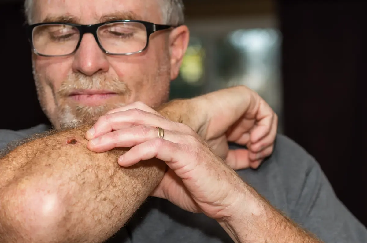 Older man checking sun-damaged skin on his face