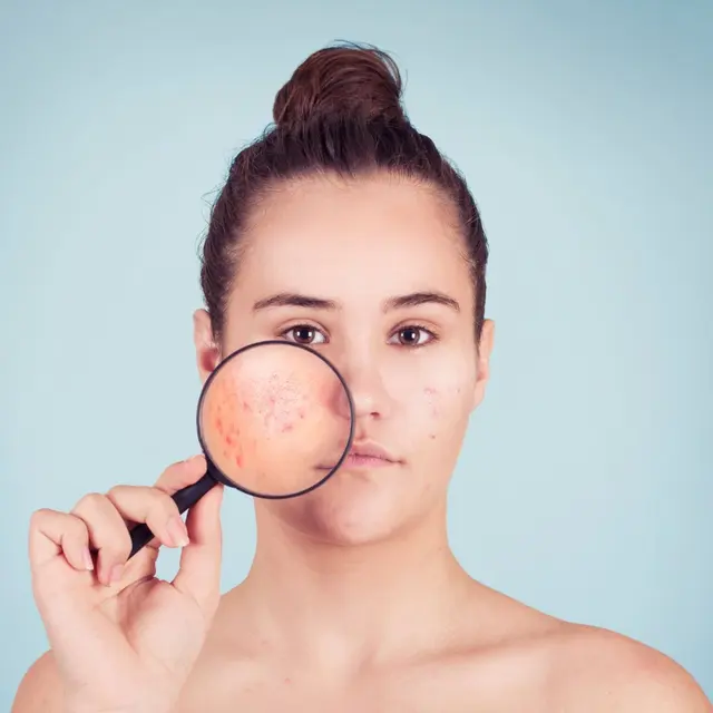 Woman checking a spot on her cheek with a magnifying glass